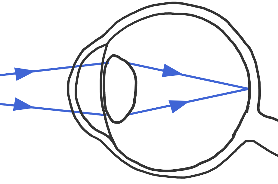 Een bolle lens die de lichtstralen afbuigt.