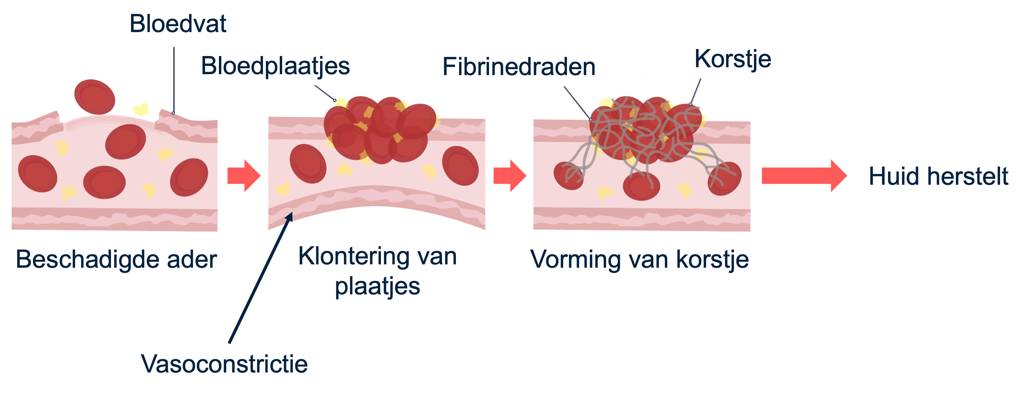 Overzicht van hoe een wond geneest.