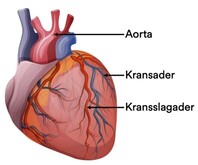 Het hart met kransaders en kransslagaders