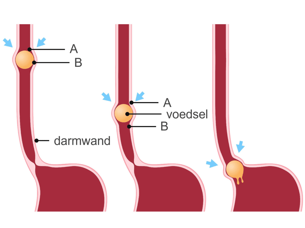 Illustratie van de darmperistaltiek waarop te zien is dat een voedselbrij door de dunne darm heen geknepen wordt met behulp van de kringspiertjes.