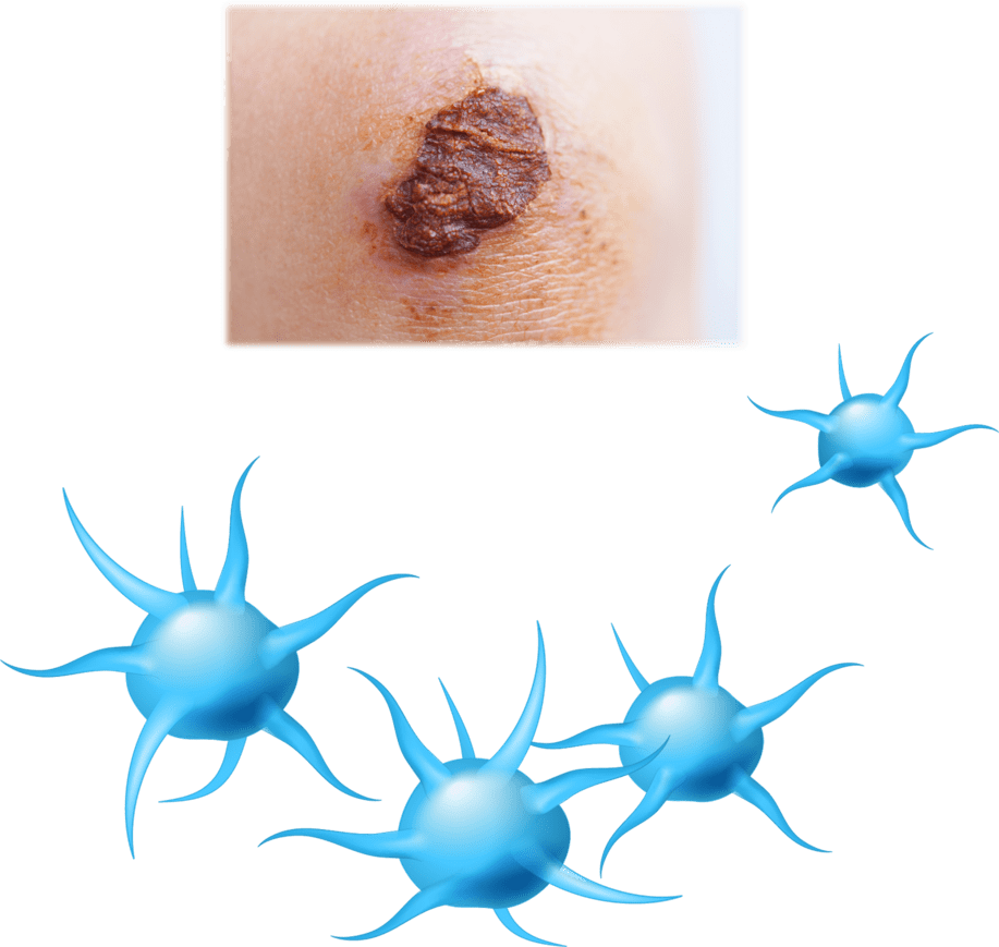 Bloedplaatsjes zijn verantwoordelijk voor de stolling van het bloed, zo wordt er een korstje gevormd.