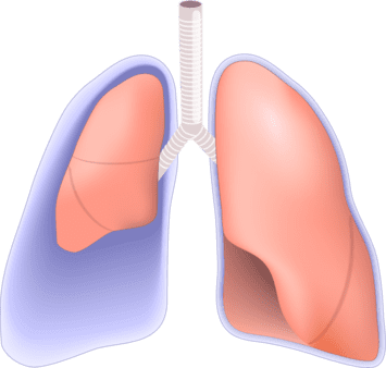 Het verschrompelen van de linkerlong doordat er lucht tussen de vliezen zit (klaplong)