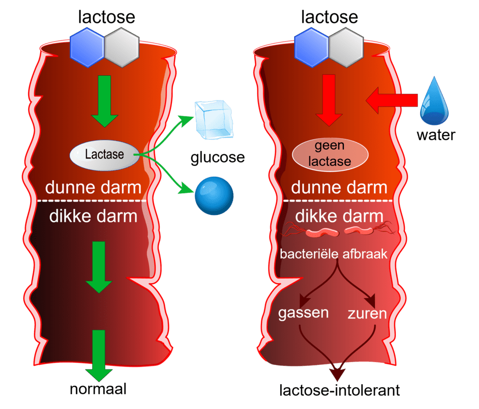 Een illustratie van hoe lactose-intolerantie het spijsverteringsstelsel beïnvloedt.