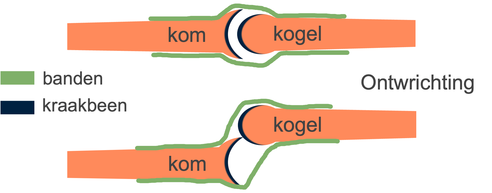 Bij een ontwrichting is de kogel uit de kom geraakt.