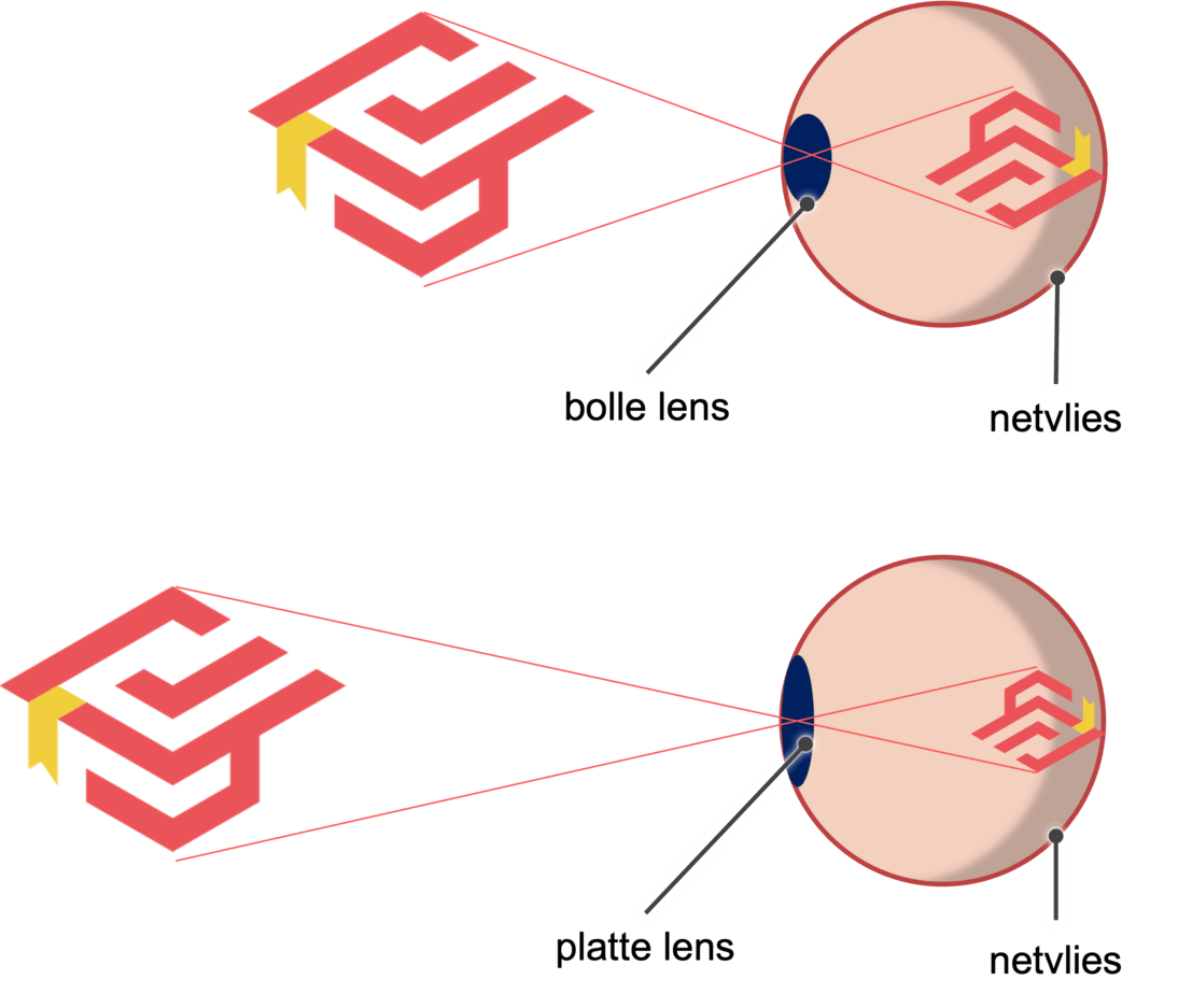 Bolle en een platte lens